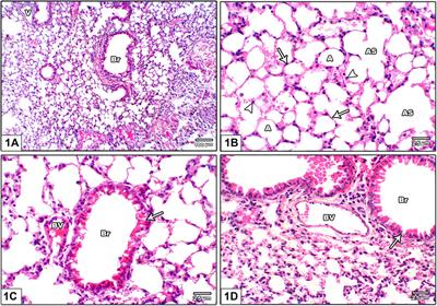 Leflunomide Induces Dose-Dependent Lung Injury in Mice via Stimulating Vimentin and NLRP3 Inflammasome Production